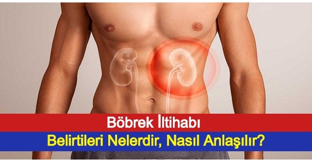 Böbrek İltihabı Belirtileri Nelerdir, Nasıl Anlaşılır?