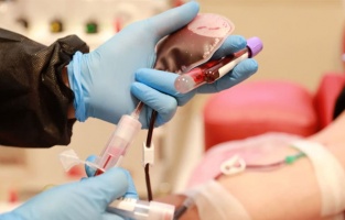 İmmün Plazma Tedavisine Resmen Başlandı